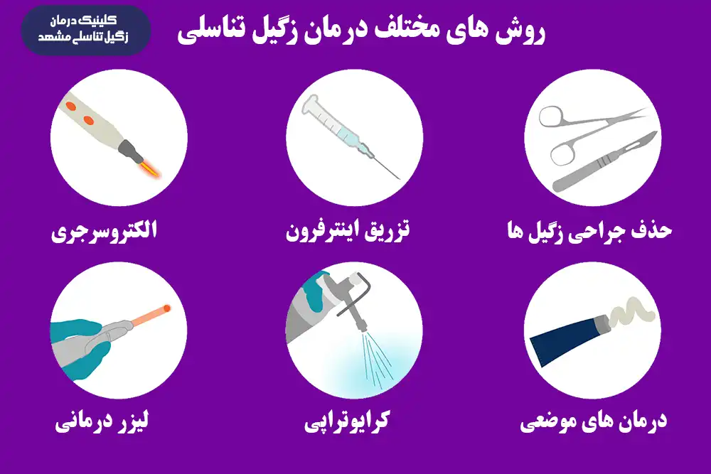 روشهای مختلف درمان زگیل تناسلی