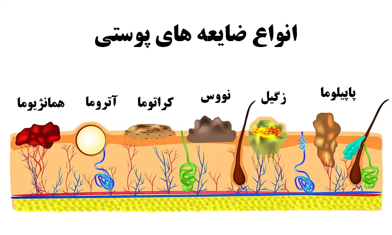 انواع ضایعه های پوستی