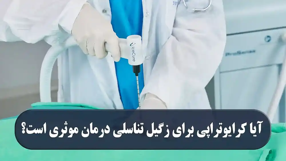 آیا کرایوتراپی برای درمان زگیل تناسلی موثر است