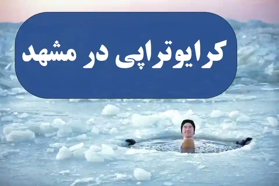 کلینیک کرایوتراپی درمان زگیل تناسلی مشهد