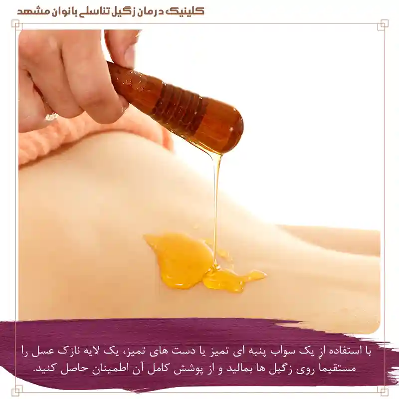 عسل را روی زگیلها بمالید