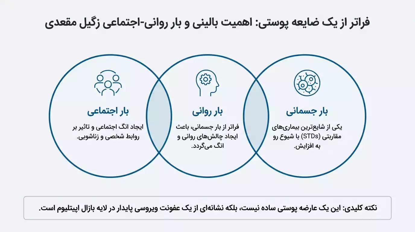 بار روانی زگیل مقعدی