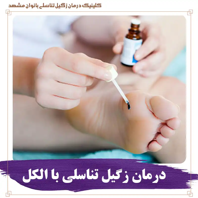 درمان زگیل تناسلی با الکل