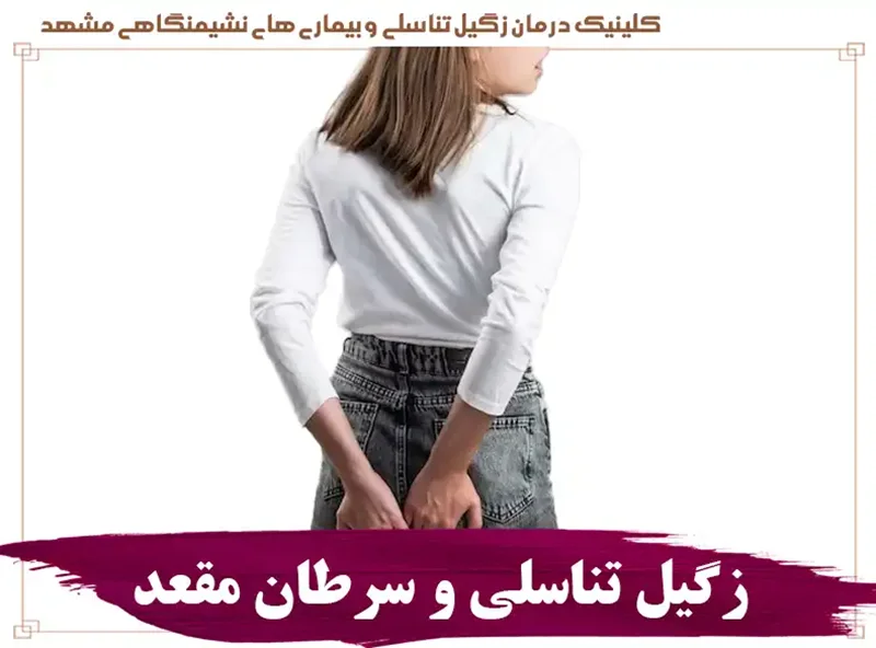 زگیل مقعدی چیست؟