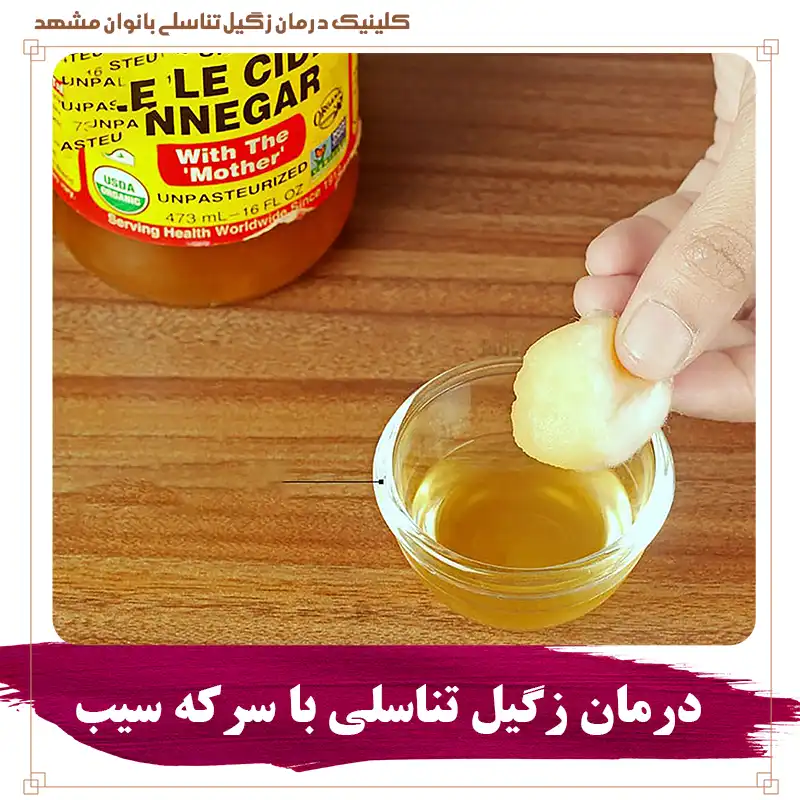 درمان زگیل تناسلی با سرکه سیب | سرکه برای درمان و تشخیص زگیل تناسلی