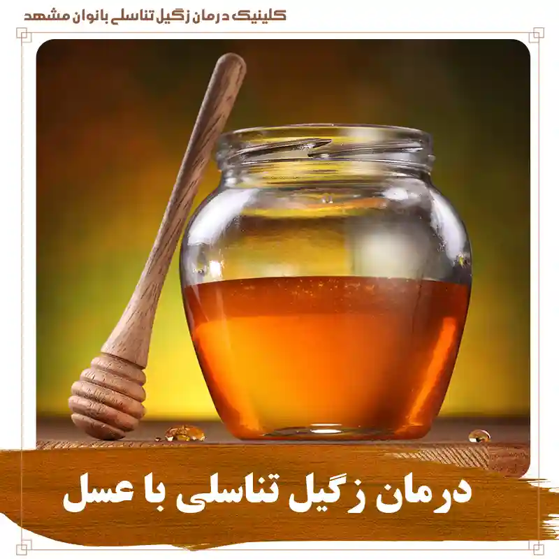 درمان زگیل تناسلی با عسل و خواص عسل برای درمان زگیل